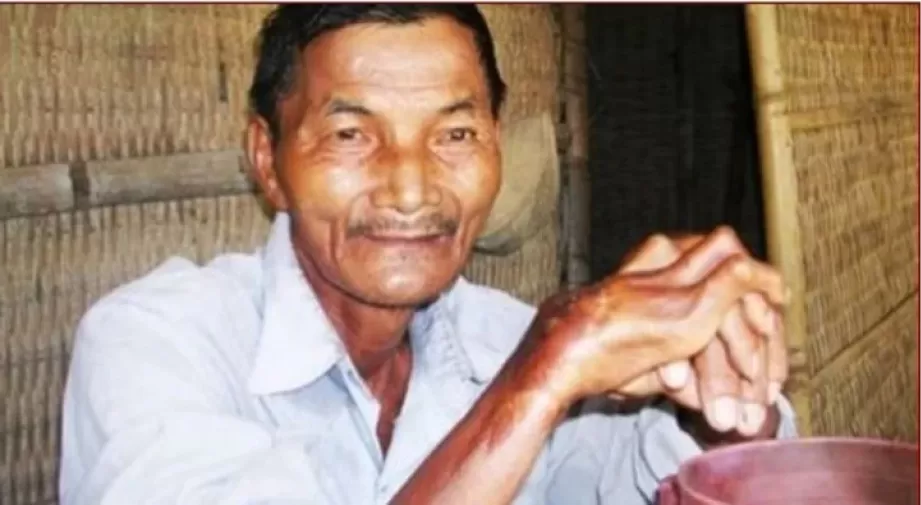 Thai Ngoc es un granjero de Vietnam que sufrió una fuerte fiebre a los 20 años y desde ese momento no duerme.