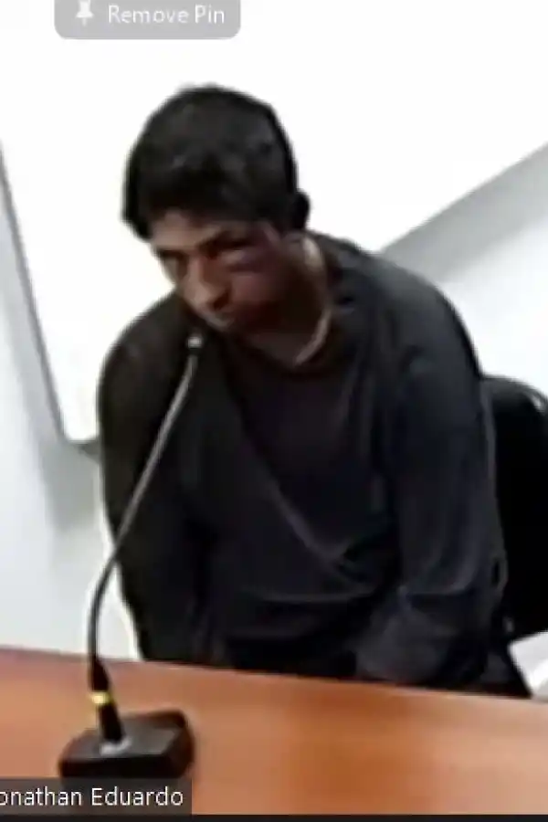 DESFIGURADO. Jonathan Jaime tenía secuelas de los golpes que sufrió.