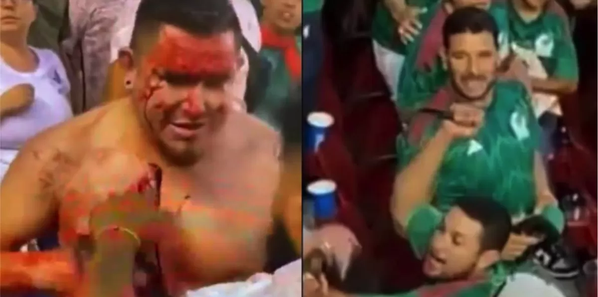Terror en la Copa Oro: un hincha fue apuñalado en el cuello durante partido entre México y Qatar