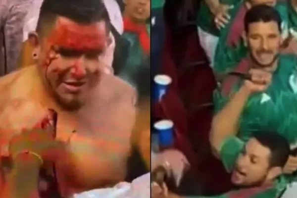 Terror en la Copa Oro: un hincha fue apuñalado en el cuello durante partido entre México y Qatar