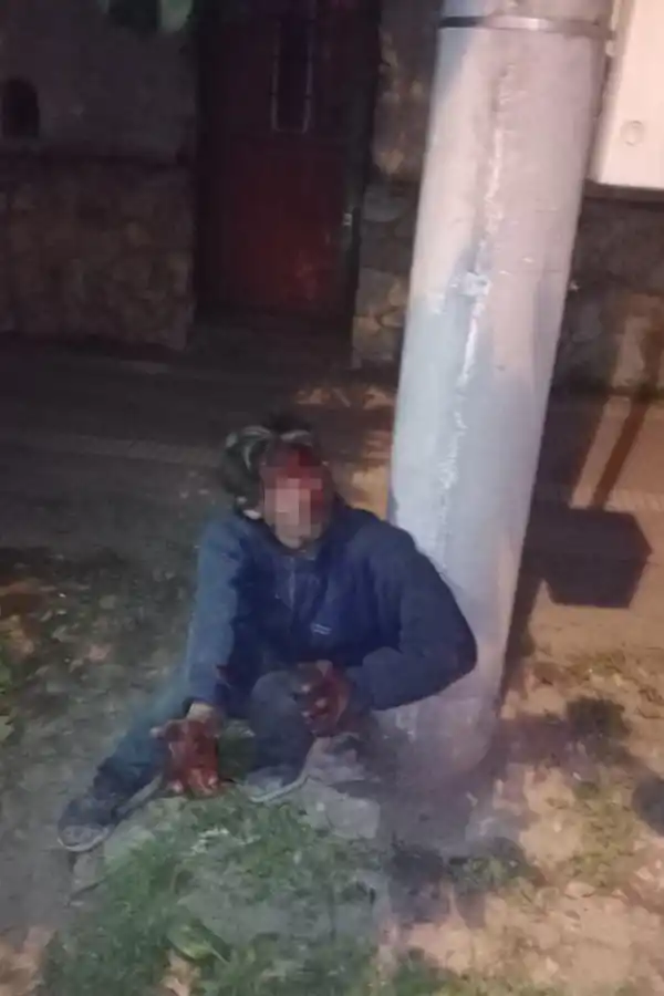 HERIDO. M.M.A. sufrió profundas lesiones tras caer del transformador  