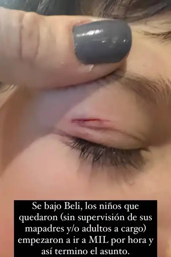 El hijo de Juana Repetto pasó un mal momento en la plaza y ella estalló de furia