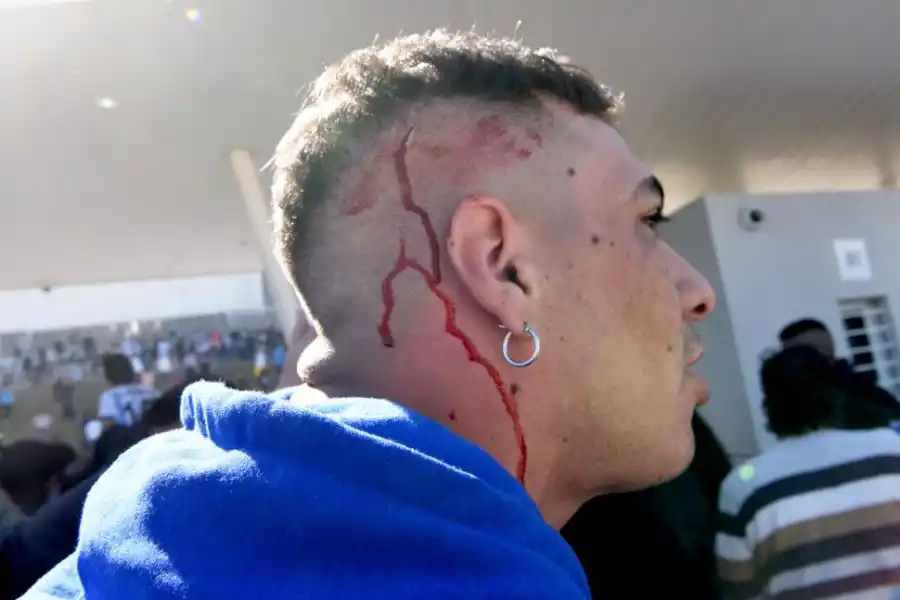 HERIDAS EN LA CABEZA. Muchos hinchas tucumanos fueron reprimidos.  