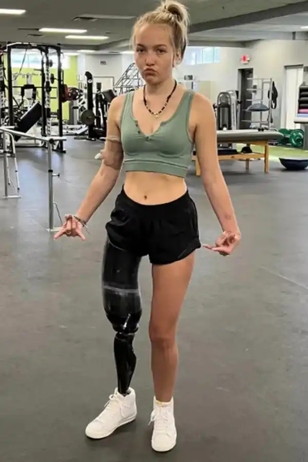 Una influencer fue atacada por un tiburón y le amputaron una pierna: “Tuve que arrancarle los ojos”