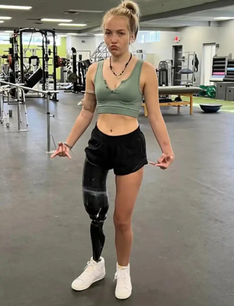 Una influencer fue atacada por un tiburón y le amputaron una pierna: “Tuve que arrancarle los ojos”