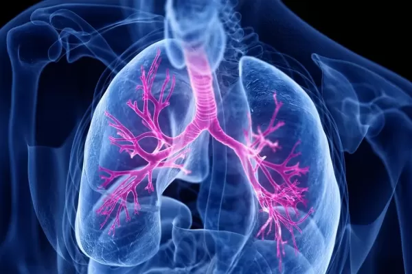 Fibrosis quística, la importancia de la detección temprana