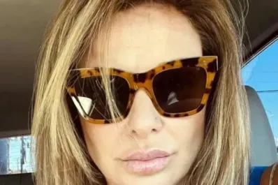 Murió una ex reina de la Vendimia tras realizarse una cirugía estética