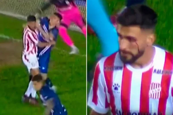 Video: la brutal trompada del jugador de Deportivo Morón que le cortó el párpado a Emanuel Dening