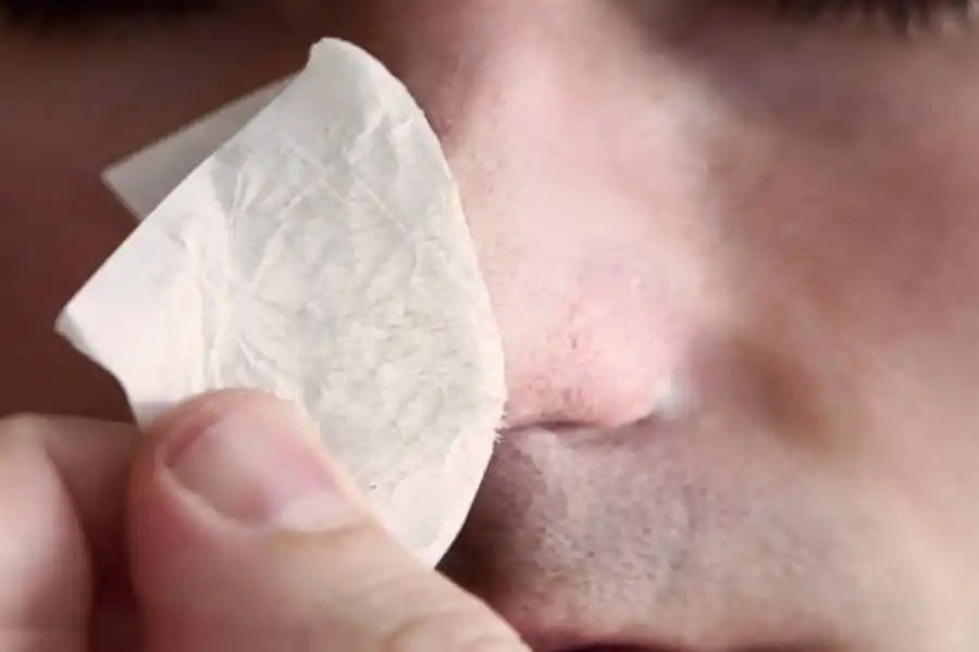 Puntos negros en la nariz: cuáles son los mejores trucos para eliminarlos