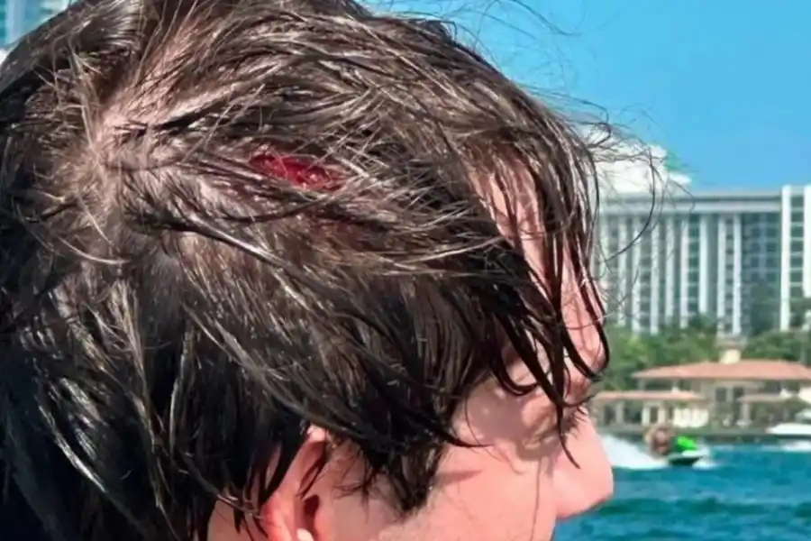 Paulo Londra sufrió un accidente en Miami: qué le pasó y cómo está