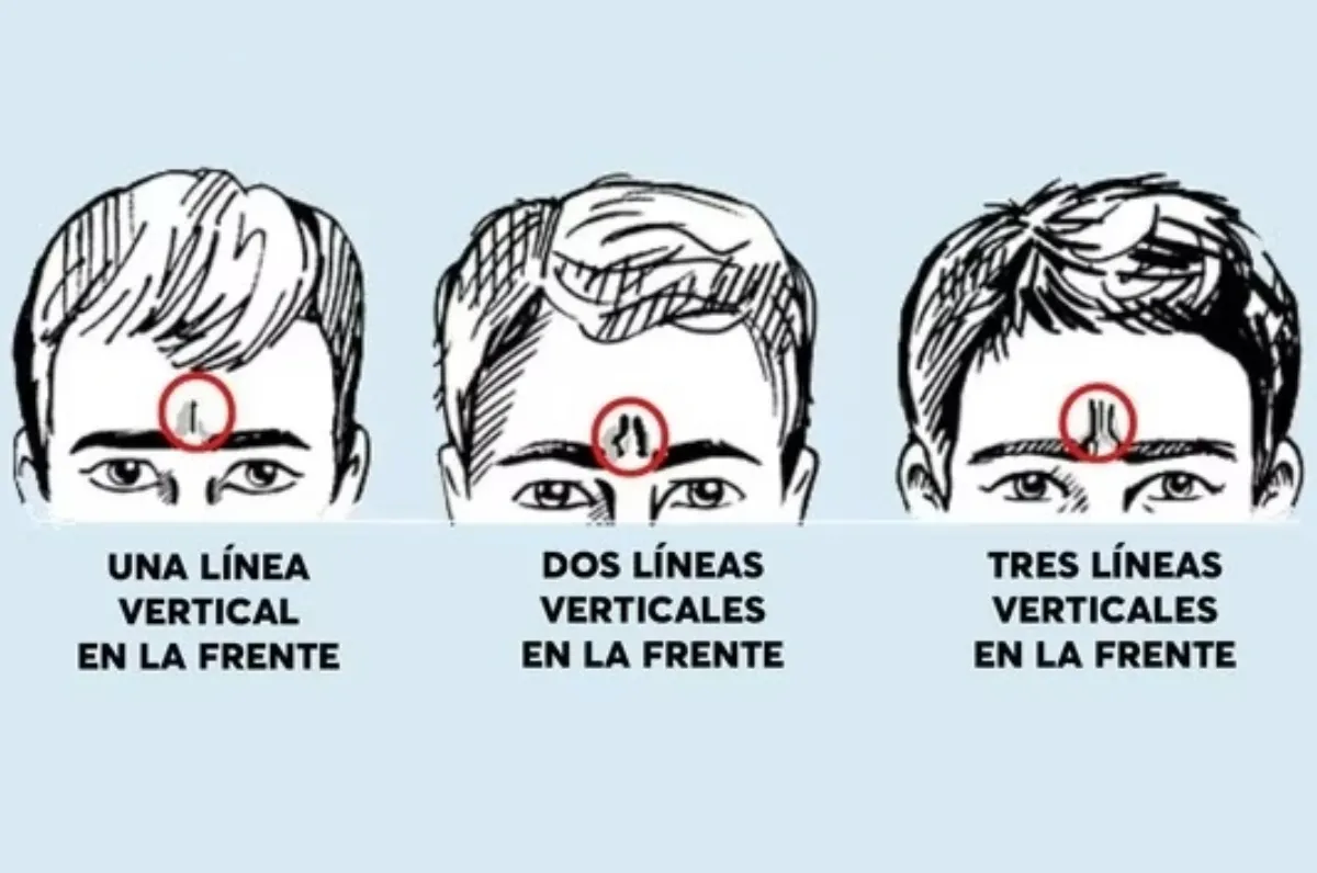 Test viral: ¿qué revelan las líneas de tu frente sobre personalidad?