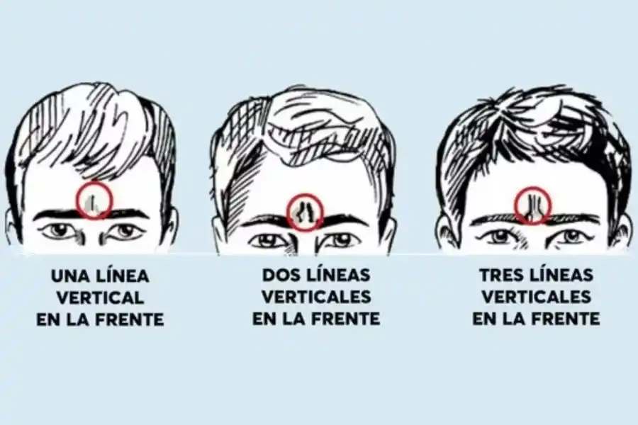 Test viral: ¿qué revelan las líneas de tu frente sobre personalidad?