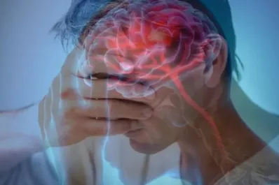 ACV: cada minuto cuenta para reducir el daño cerebral