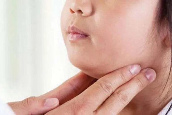 Streptococcus pyogenes: los 10 puntos para conocer esta enfermedad