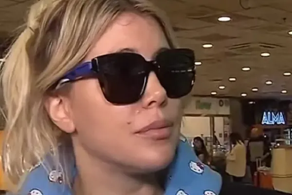Las fotos de Wanda Nara con moretones que causaron preocupación