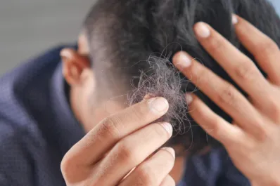 La vitamina que tu cabello necesita para evitar la caída: todo lo que debes saber