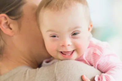 Síndrome de Williams, el raro  trastorno genético que hace a los niños demasiado extrovertidos