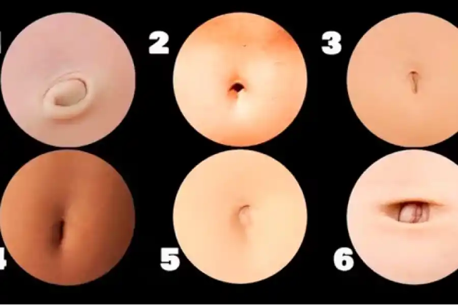 Con honestidad y sin pensarlo mucho, elegí cuál de las opciones se parece más a tu ombligo.