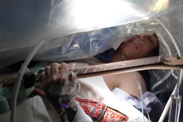 Concierto en el quirófano: un guitarrista tocó mientras le extirpaban un tumor en el cerebro