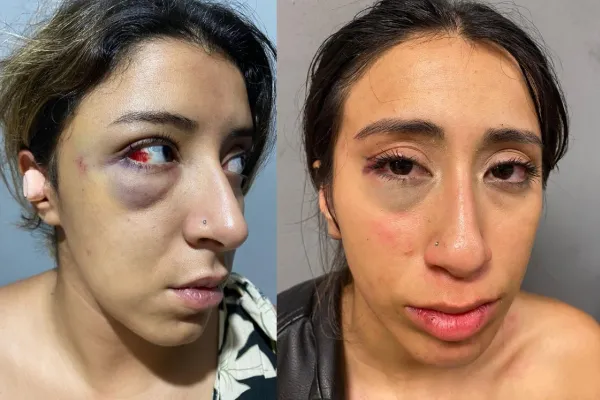 Atacaron a dos chicas a la salida de un boliche en Tucumán: “Pudo haber sido otro caso Báez Sosa”