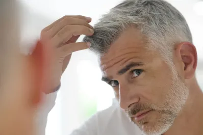 ¡Chau canas y sin tintura! Los ingredientes que se pueden agregar al shampoo para eliminarlas