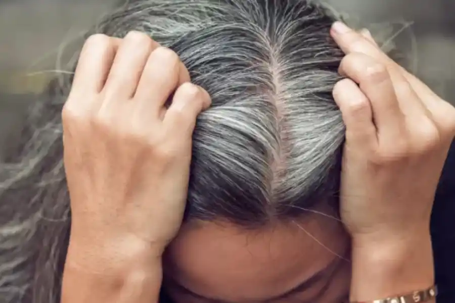 ¡Chau canas y sin tintura! Los ingredientes que se pueden agregar al shampoo para eliminarlas
