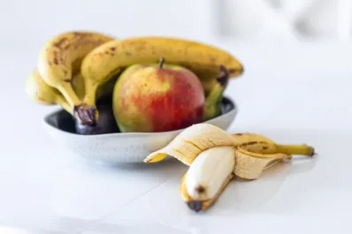¿Es sano comer una banana por día? Un estudio evaluó cuáles son sus beneficios