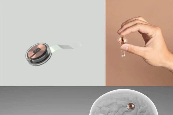 Un futuro a la medida: ¿hacia dónde nos lleva el “hackeo” del cerebro?