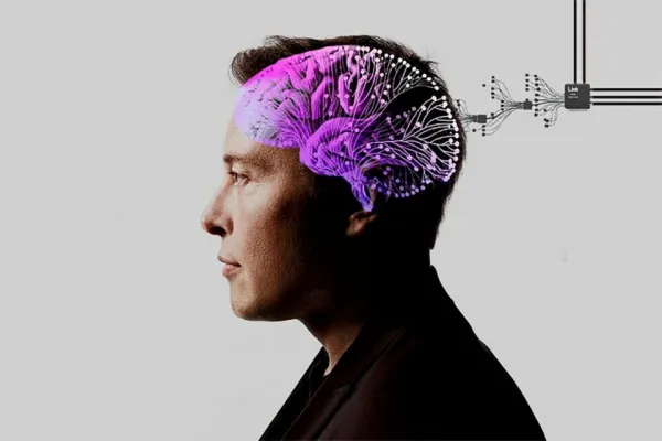 Elon Musk implementó el primer chip cerebral: ¿cómo funciona?