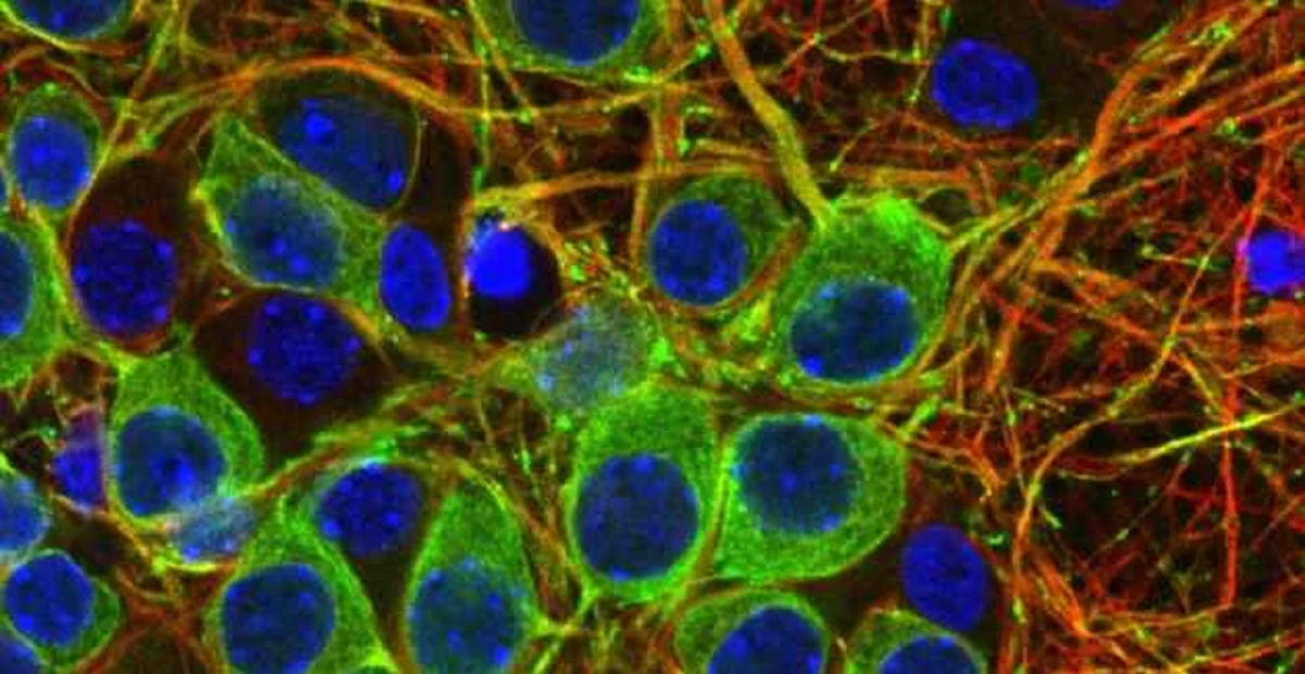 El estudio se basó en experimentos realizados en dos modelos celulares: neuronas de cerebro de ratón (en la imagen) y células humanas.