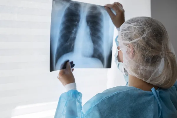 Anmat aprueba un nuevo tratamiento contra el cáncer de pulmón que alarga el pronóstico de vida