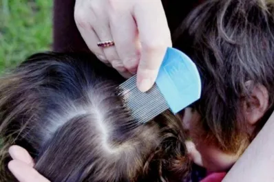 Vuelta a clases: ¿cómo evitar los piojos en los niños?