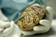 Alzheimer: cuál es la hormona que ayudaría a prevenirlo y a mejorar la memoria