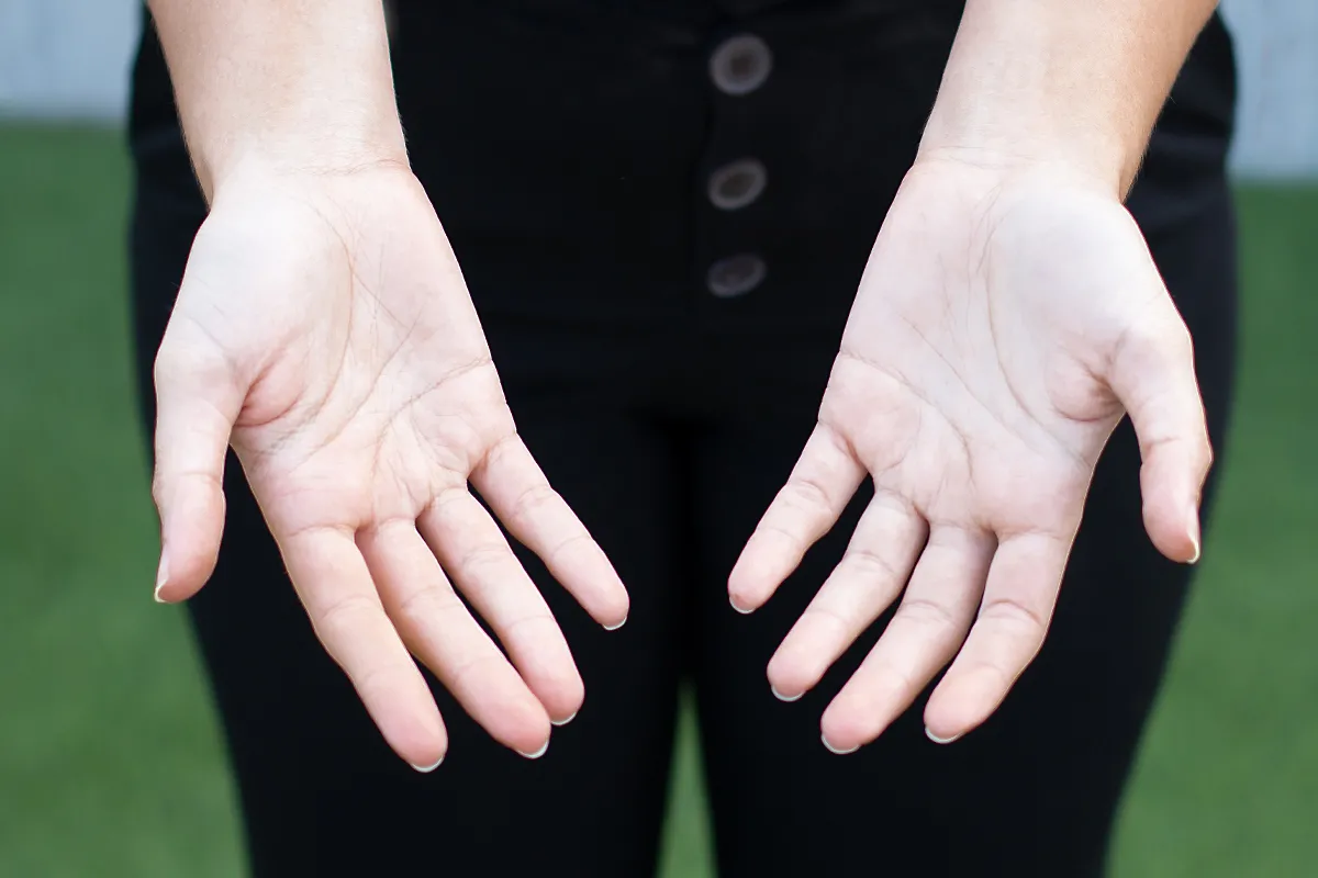 Cinco señales de enfermedades que pueden avisarnos nuestras manos y no lo sabemos