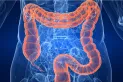 Cáncer de colon: ¿qué alimentos ayudan a prevenirlo y cuáles son nocivos?