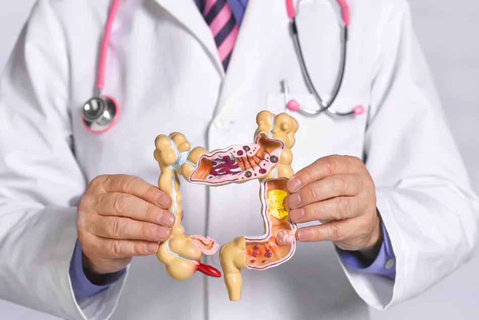 Cáncer de colon: guía completa para la prevención y detección temprana