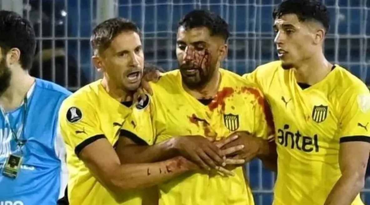 El jugador de Peñarol luego de recibir un piedrazo en la cancha de Central. 