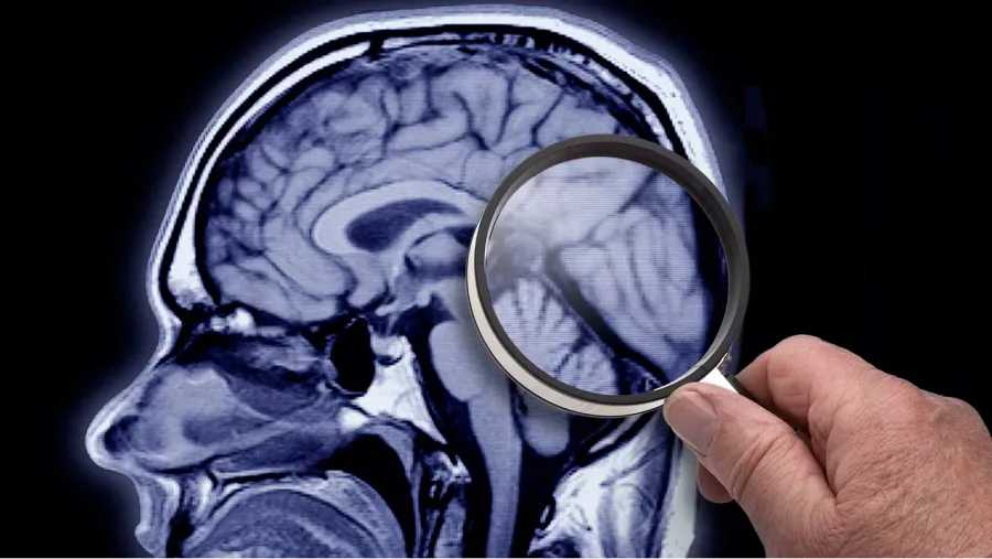 Alzheimer: los síntomas que contribuyen a la detección temprana de la enfermedad
