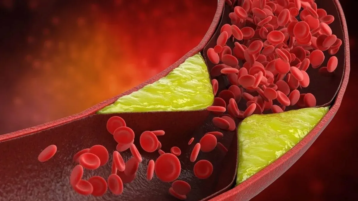 Curiosidades sobre el colesterol, según la Universidad de Yale. 