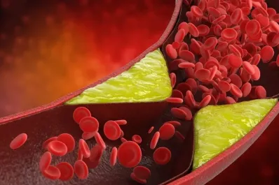 Médicos de la Universidad de Yale detallaron cuáles son las peculiaridades sobre el colesterol que pocos conocen