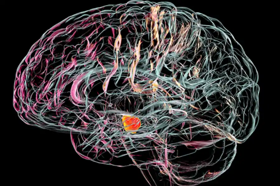Cómo detectar el parkinson antes de que aparezcan los primeros síntomas