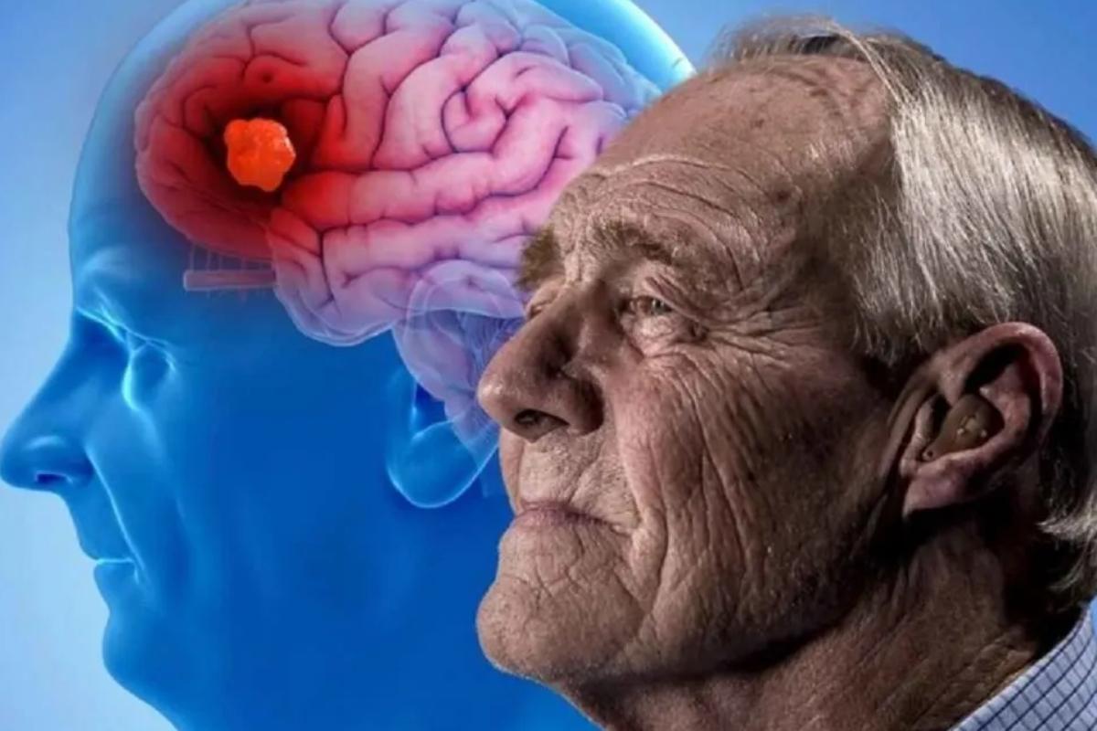 Por qué debemos dormir bien para prevenir el Alzheimer