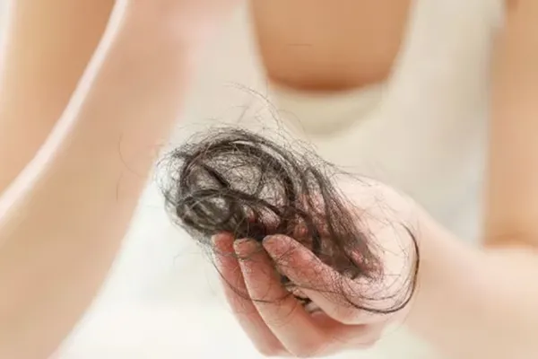 Estas son las vitaminas que frenan la caída del pelo y cómo consumirlas