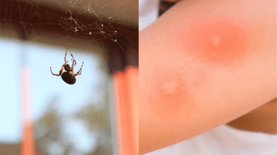 Picaduras de araña: cuáles son los riesgos, cómo identificar las más peligrosas y cómo actuar ante ellas