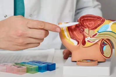 Cáncer de próstata: cuáles son los síntomas para ir urgente al médico