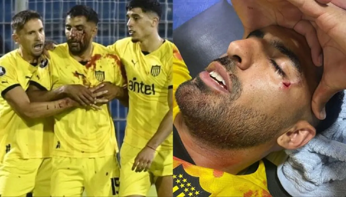GRAVE INCIDENTE. Maximiliano Olivera, jugador de Peñarol, fue lastimado por un proyectil, cuando saludaba a la parcialidad uruguaya.