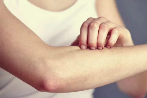 Cáncer de páncreas, uno de los más difíciles de detectar: ¿por qué cierta picazón es clave para descubrir la enfermedad?