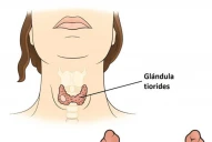 Bultos en el cuello: cómo reconocer si pueden ser signos de cáncer de tiroides
