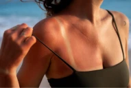 El callo solar no existe: alertan sobre una práctica difundida en Tik Tok que puede generar cáncer de piel