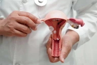 ¿Es dolor menstrual o endometriosis? Las señales que pueden marcar la diferencia